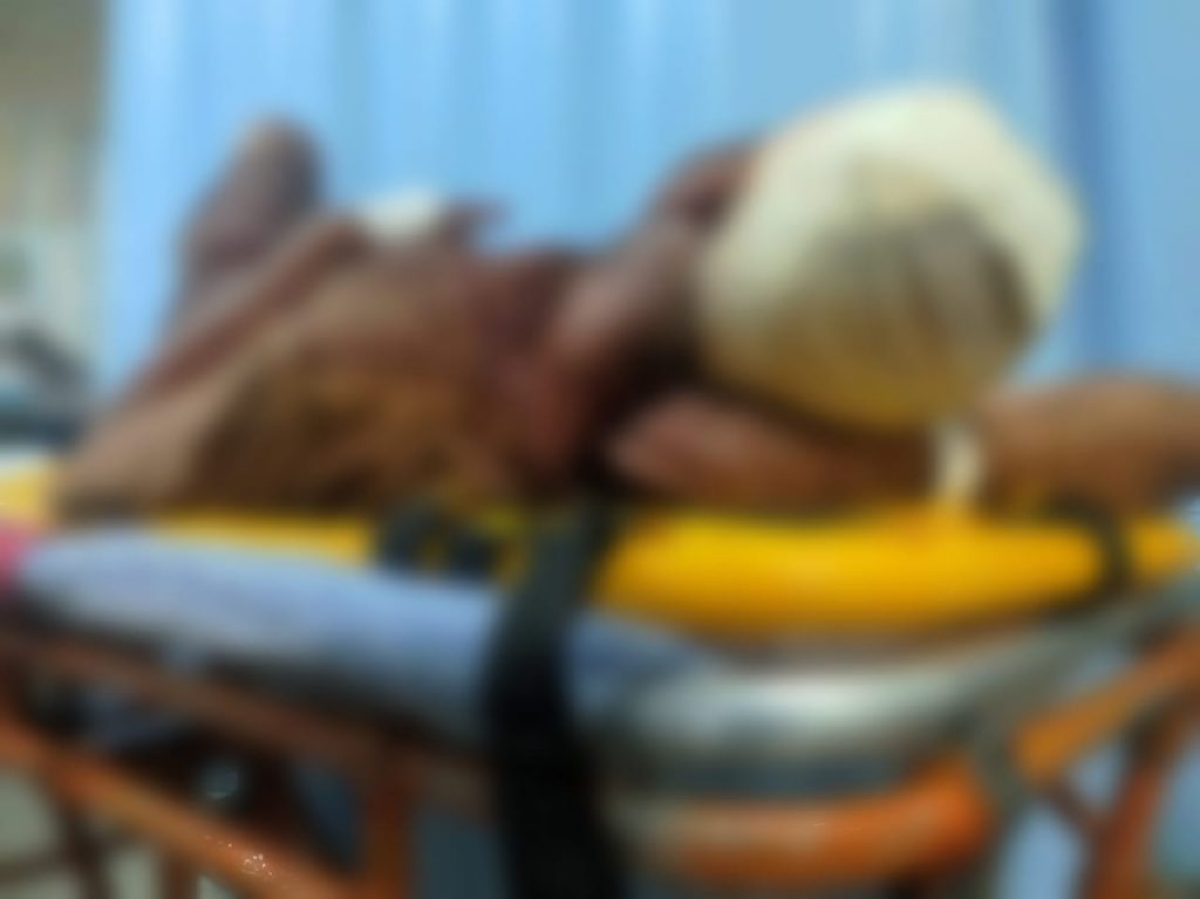 Saúde alerta sobre riscos de trauma na face - Foto: SES/SE