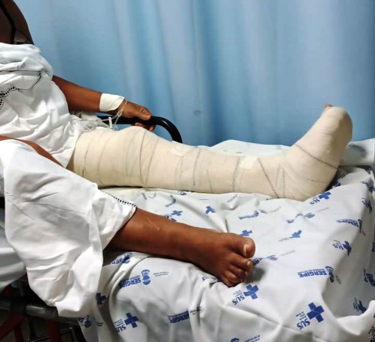 Cresce o número de cirurgias ortopédicas no Hospital de Urgências de Sergipe - Foto: SES/SE